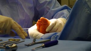 foot surgery